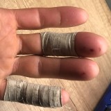 Sigi's taped fingers